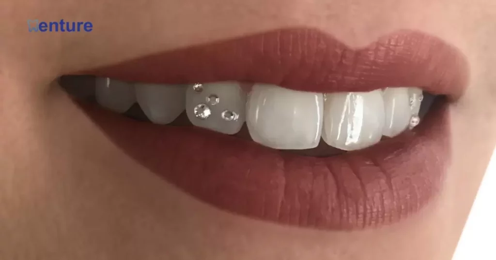 What Glue Can I Use For Tooth Gems?