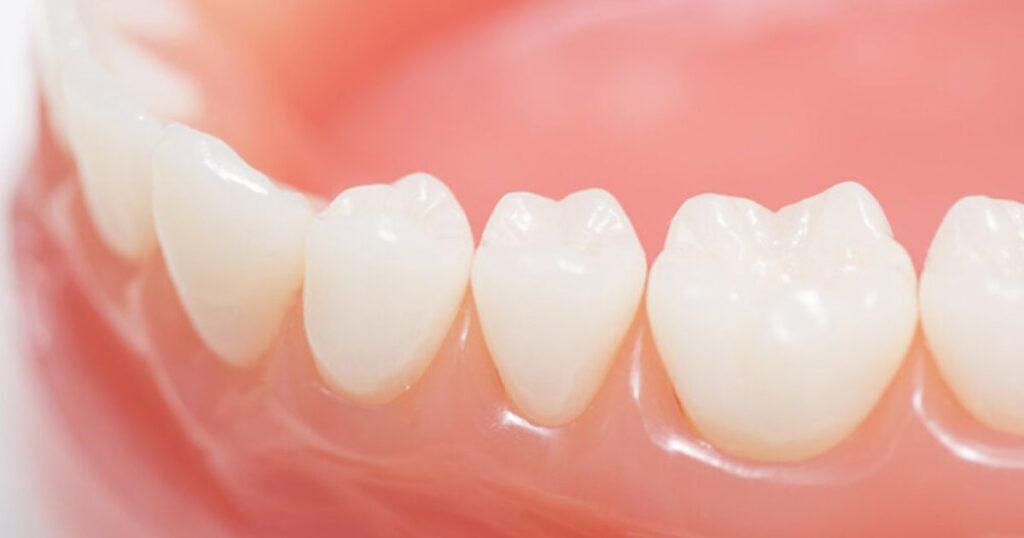 Acrylic Resin: Primary Material in Dentures