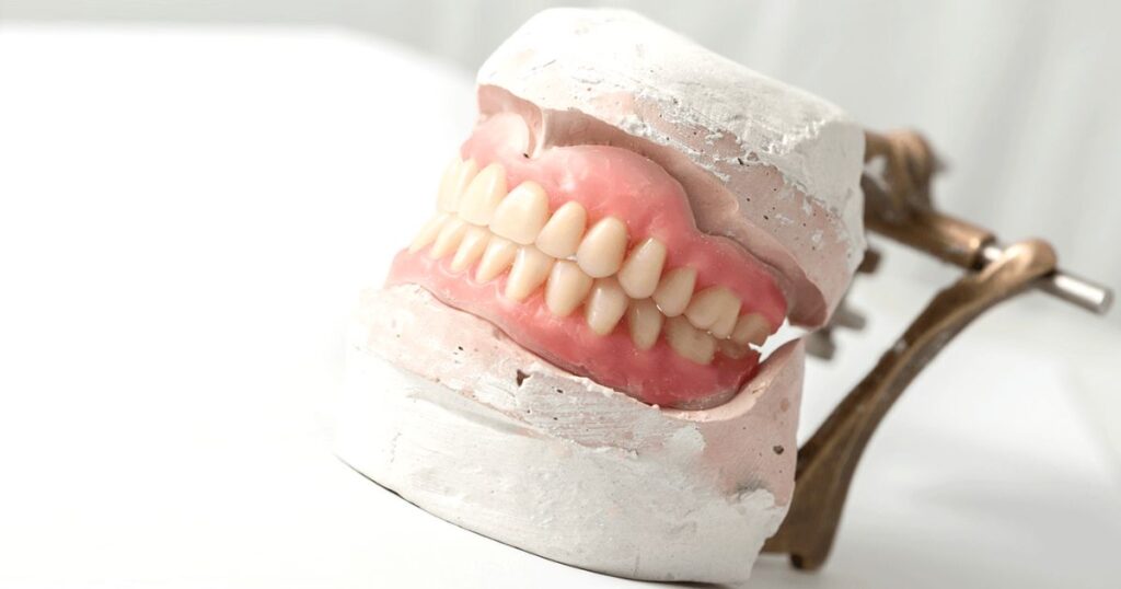 Adjustments and Follow-Up for Partial Dentures