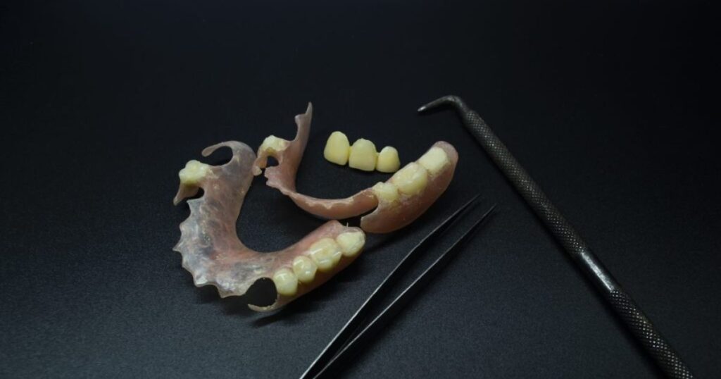Adjustments and Relining of Upper Partial Dentures
