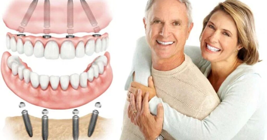 Benefits of Affordable Dentures and Implants