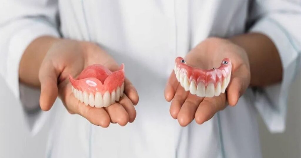 Benefits of Implant Dentures Over Traditional Dentures
