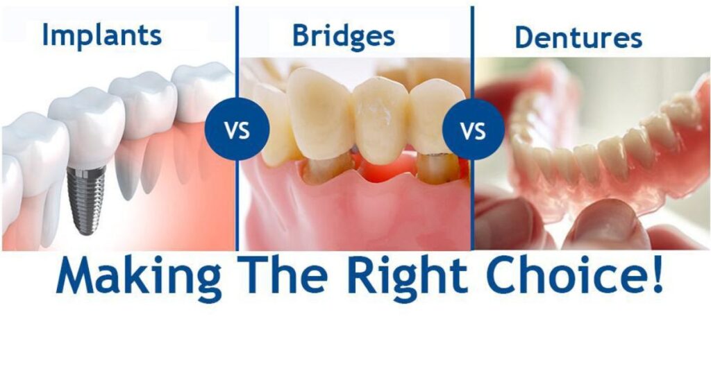 Comparing Affordable Options to Traditional Dentures and Implants