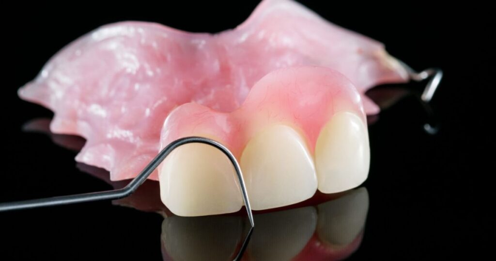 Nylon-Based Denture Material