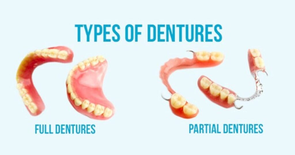 Partial Dentures vs. Full Dentures: A Comparison
