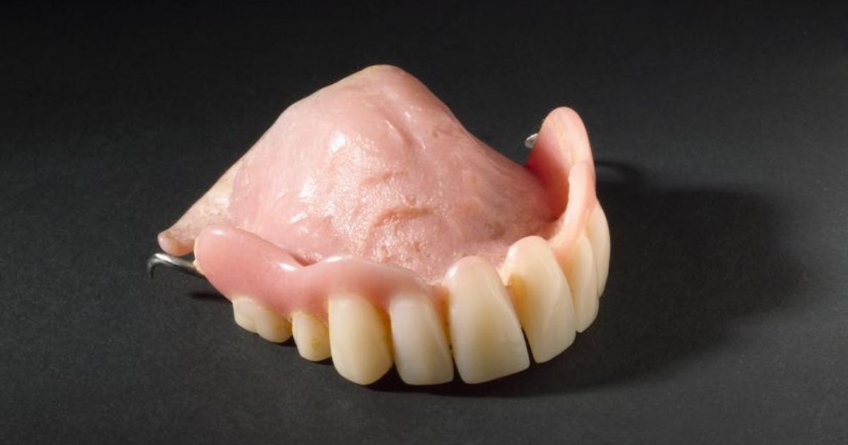 Upper Partial Denture