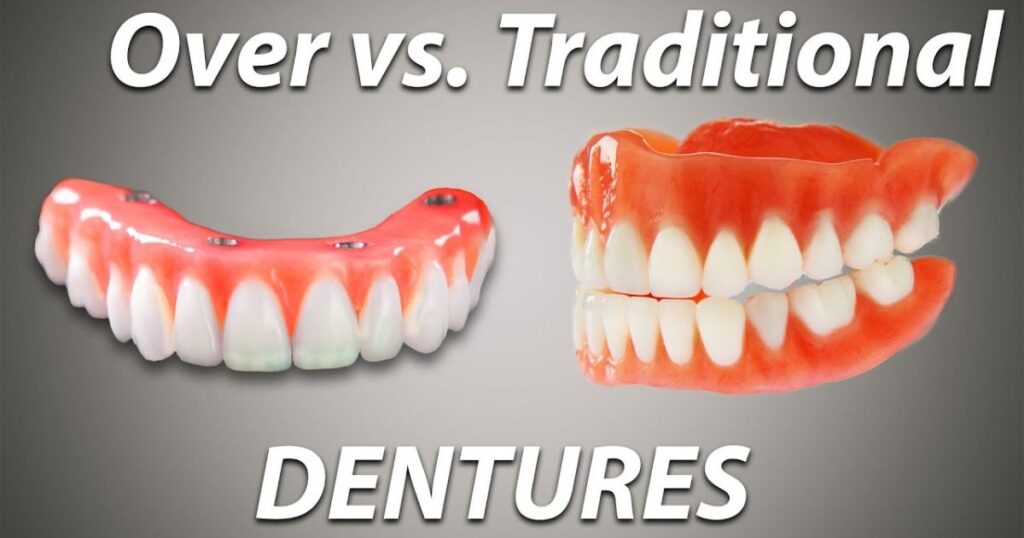 Cost Comparison: Snap-In vs. Traditional Dentures