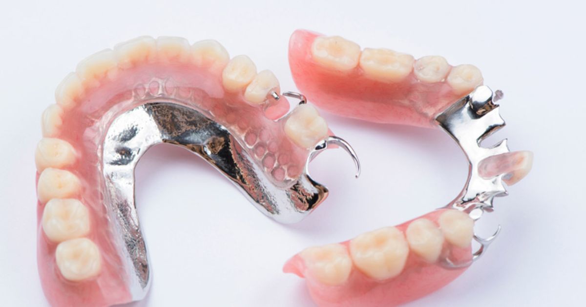 Partial Dentures Cost