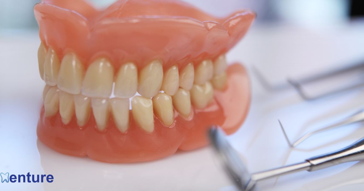 Types of Partial Dentures