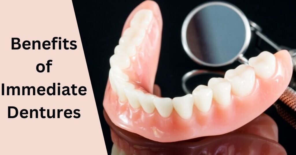 Benefits of Immediate Dentures