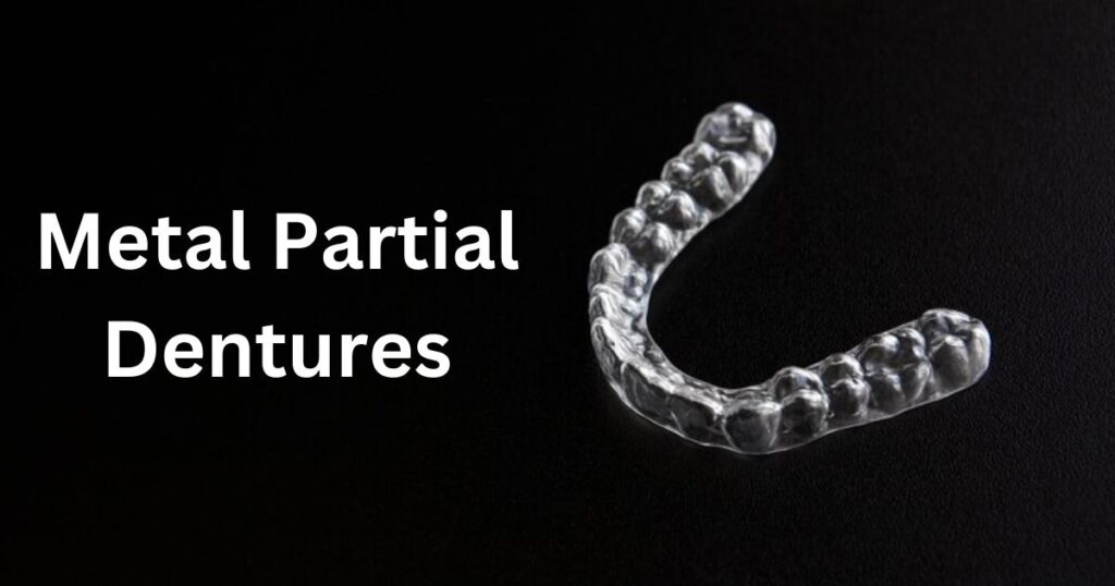 Metal Partial Dentures