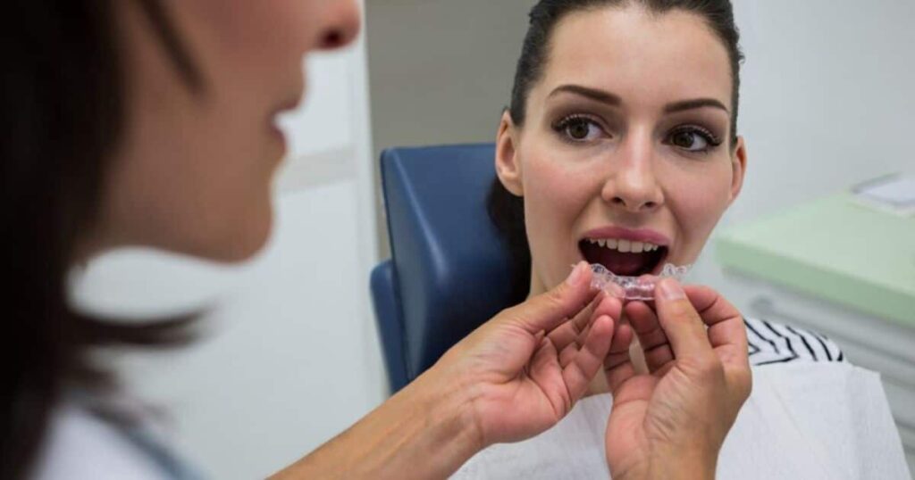The Dental Sealant Procedure