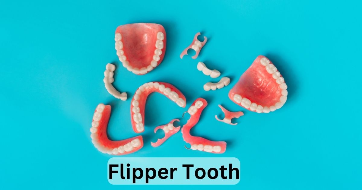 Flipper Tooth: What You Need to Know