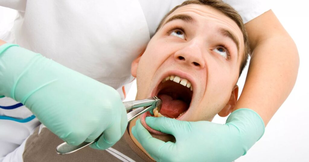 How Long Until an Untreated Tooth Infection Becomes Deadly