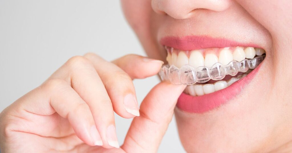How does bruxism impact orthodontic treatment beyond Invisalign?