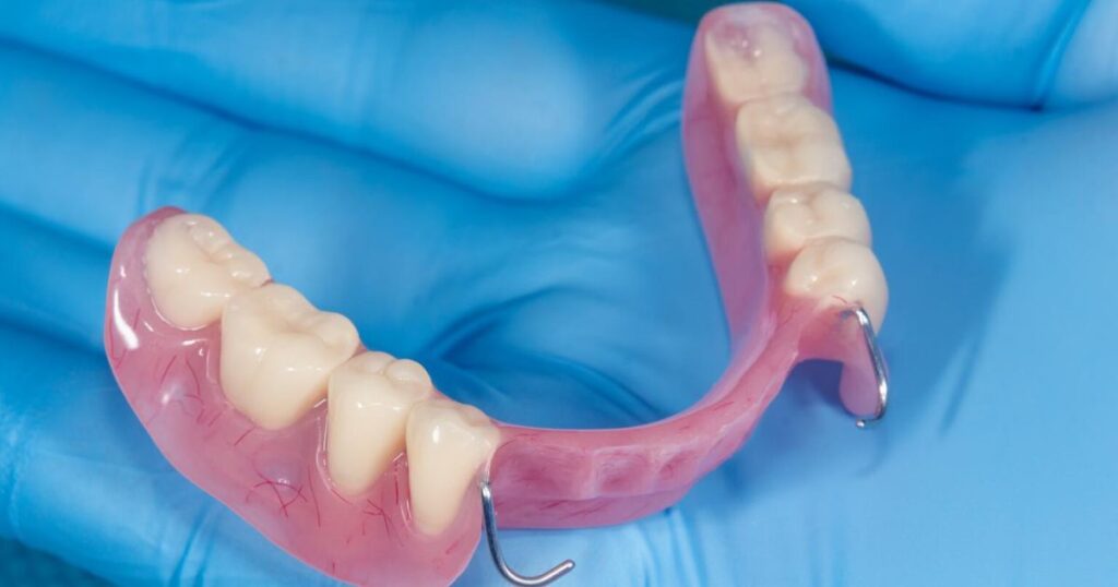 Partial Dentures: A More Affordable Starting Point